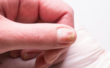 Warning Signs on Your Nails That Indicate Thyroid Issues